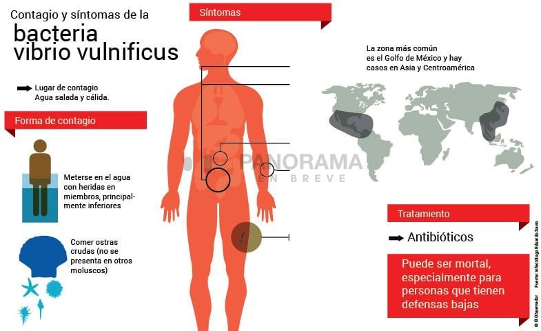Florida confirmó la primera muerte de 2026 relacionada con una infección por Vibrio vulnificus.